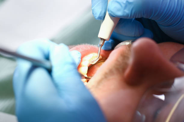 Best Emergency Treatment for Jaw Pain or Injury in Minooka, IL